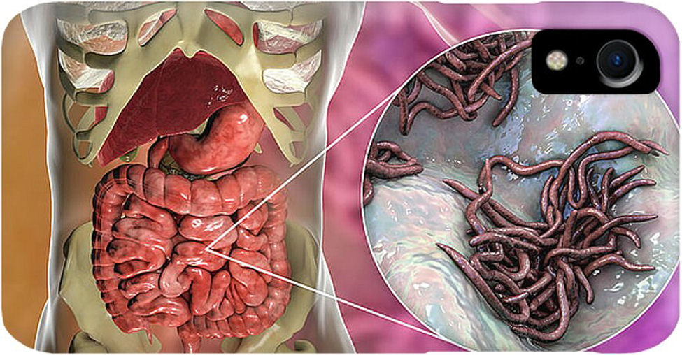 Just some parasites that infect the human body; especially when bioweapons have been forced upon the populace.