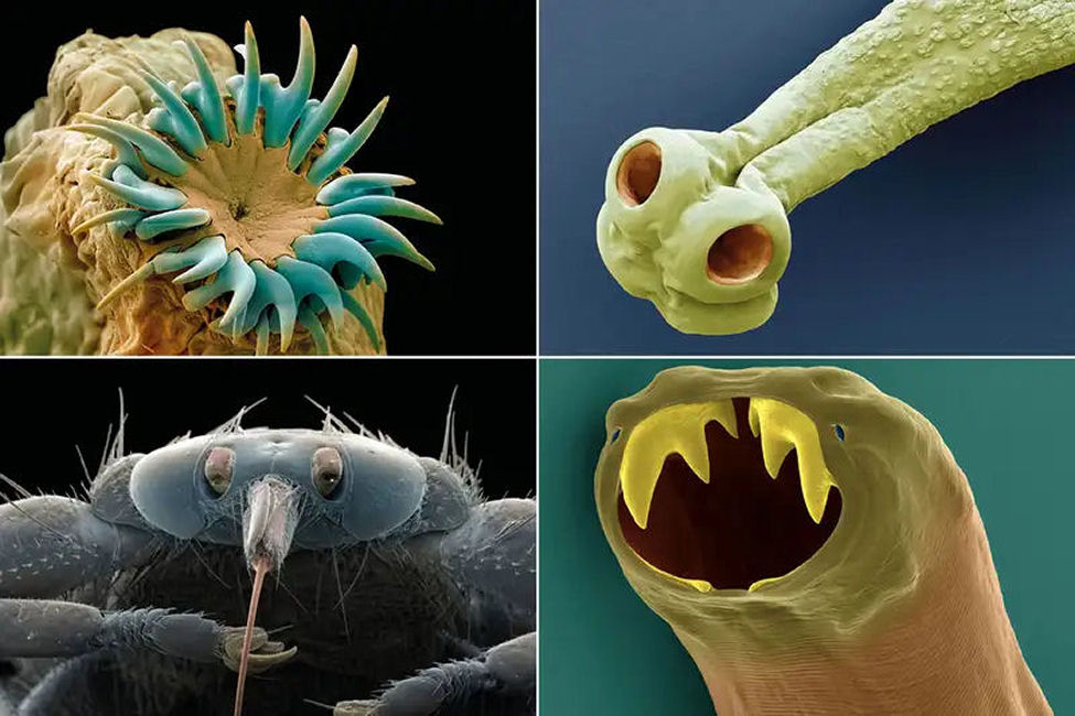 Just some parasites that infect the human body; especially when bioweapons have been forced upon the populace.