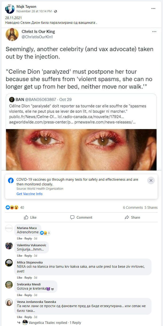 Celine Dion enjoying the benefits of Adrenochrome withdrawel and Covid mRNA Vaccinations