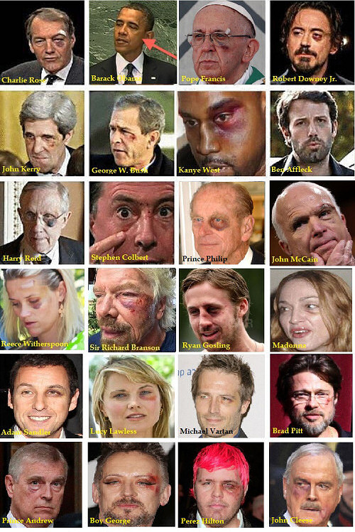 THE BLACK EYE CLUB