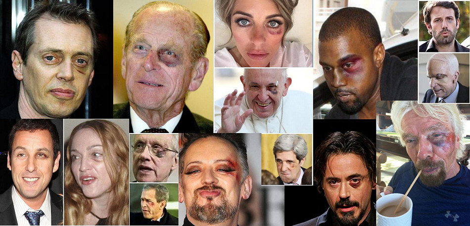 THE BLACK EYE CLUB