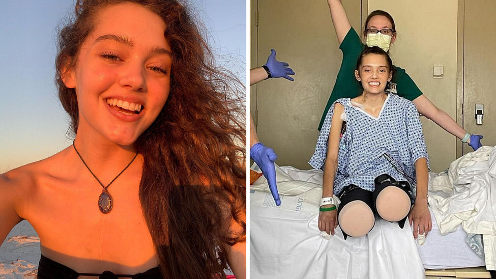 21 year old fully vaccinated model Claire Bridges lost both legs from Covid complications